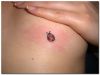 ladybug picture tattoo