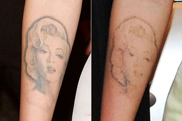 itattooz-megan-fox-tattoo-removal